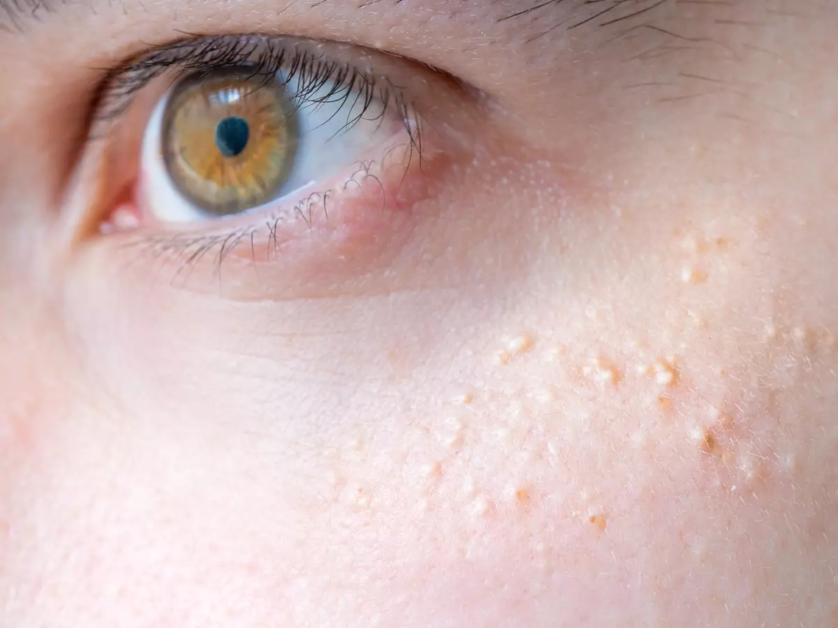 252184478 gettyimages 519167858