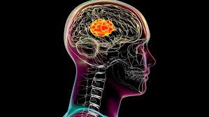 images 2025 07 28T150558.765