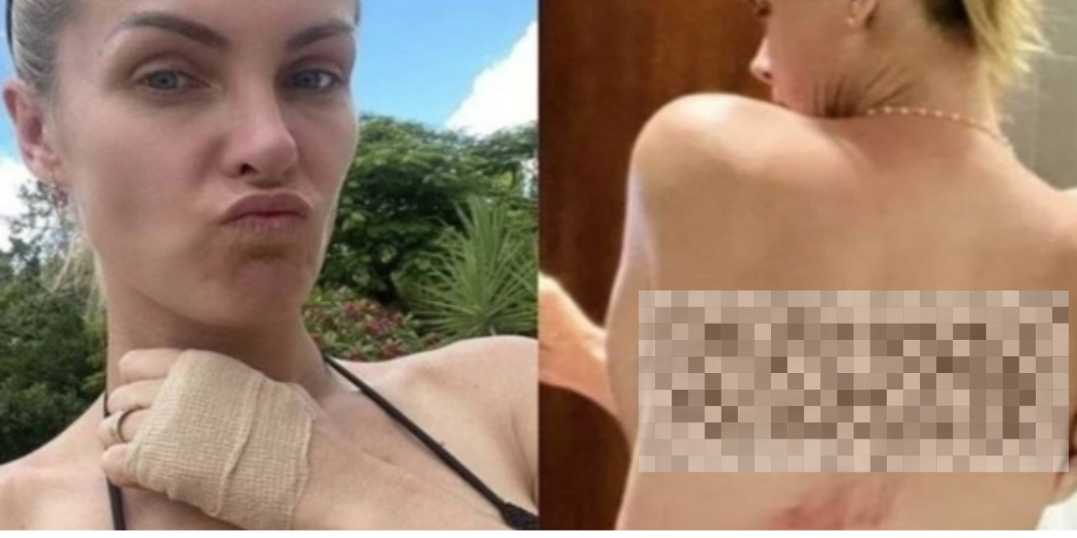 Ana Hickmann não apresenta Hoje em Dia após se manifestar a…Ver mais