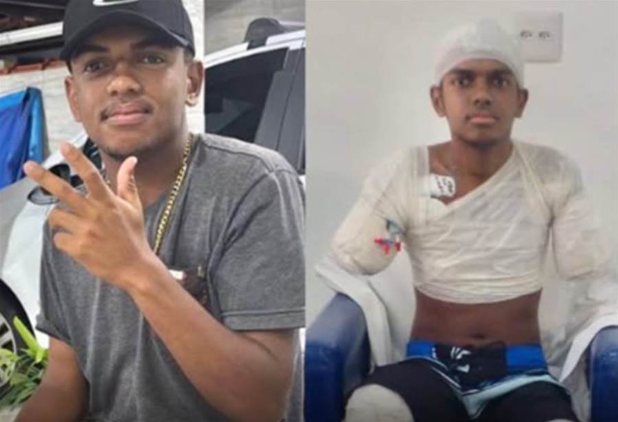 Jovem de 16 anos perde braç0s e pern4s para salvar o pai de..Ver mais