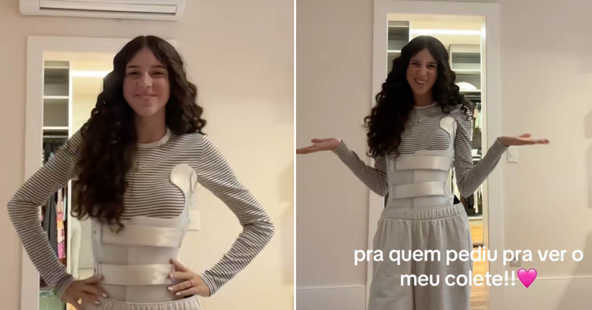 Estes São Os 03 Sintomas da Escoliose Que Rodrigo Farou Ignorou Em Sua Filha: “Est…Ver mais