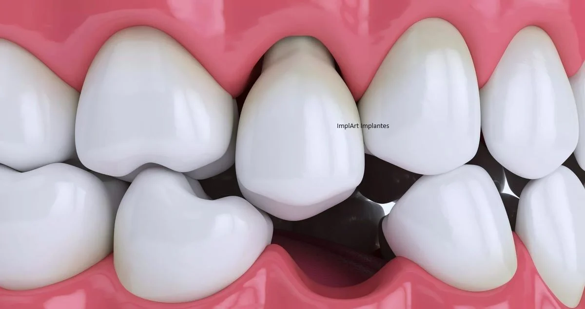 Descanse Em Paz Rodrigo: Homem Acaba M0rrendo Após Ir Ao Dentista E Ele Arrancar O Seu… Ver Mais