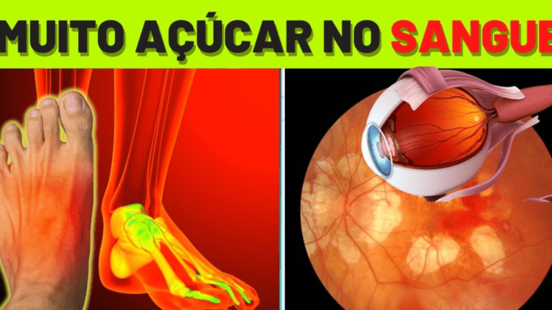 Após diabetes José Loreto foi …Ver Mais