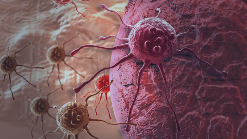 Fique Atento Aos 8 Sinais, Que O Corpo Avisa Que Pode Estar Com Um Câncer… Ler matéria