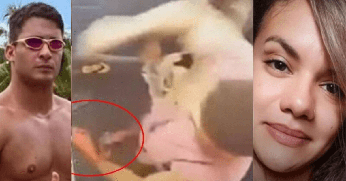 Mão Do Homem Que Agr3diu Namorada No Elevador Fica Irreconhecível “Apenas O Oss… Veja as fotos