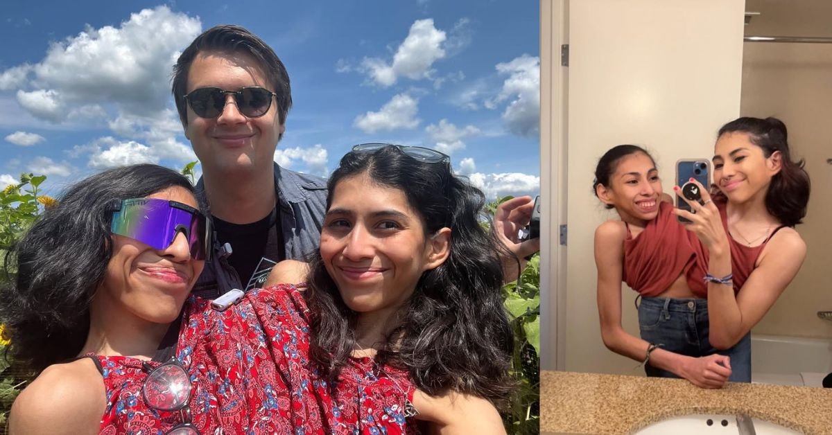 Marido de Siamesa Perde a Paciência e Solta o Que Ninguém Esperava Ouvir… Ver mais
