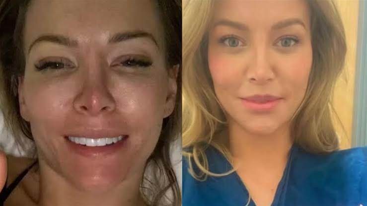 Mulher que f1ngiu ter câncer terminal e engan0u namorado para cirurgia estética acaba sendo…Ver mais