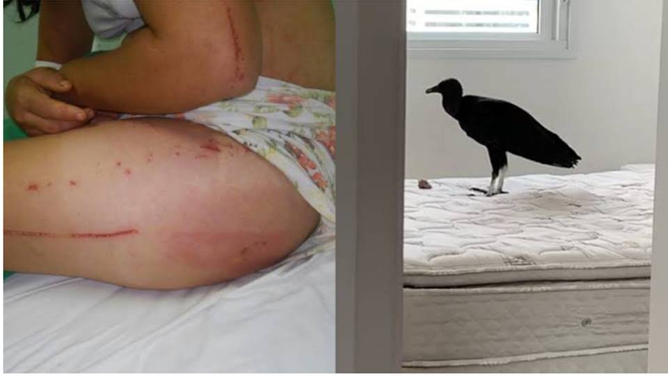 Mulher Com Mau Cheir0 Nas Partes Íntim@s é At4cada Por Urubus Durante…Ver mais