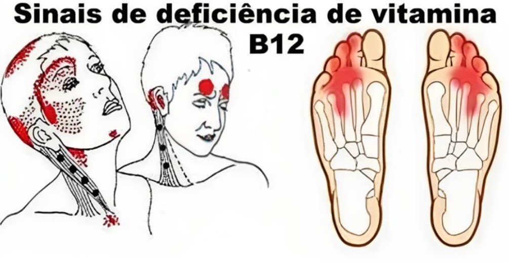 Muitas pessoas sentem a carência de vitamina B12, mas nem imaginam. Veja os principais sintomas… Ver +