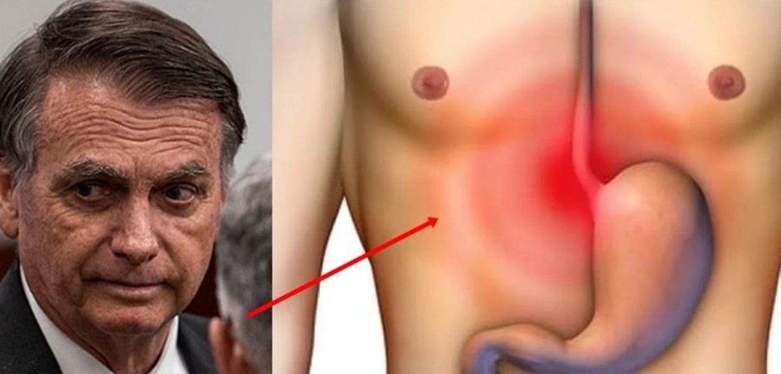 Após visita médica, triste notícia sobre Bolsonaro é divulgada, ele n… Ver mais