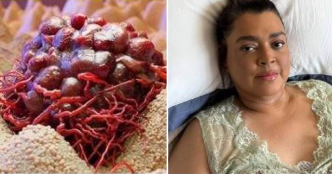 10 Cheiros de Câncer que as Pessoas Costumam Ignorar – Muito cuidado com 5… Veja mais