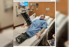 Max amstrong amputado frigideira 2