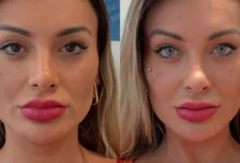 antes e depois andressa urach