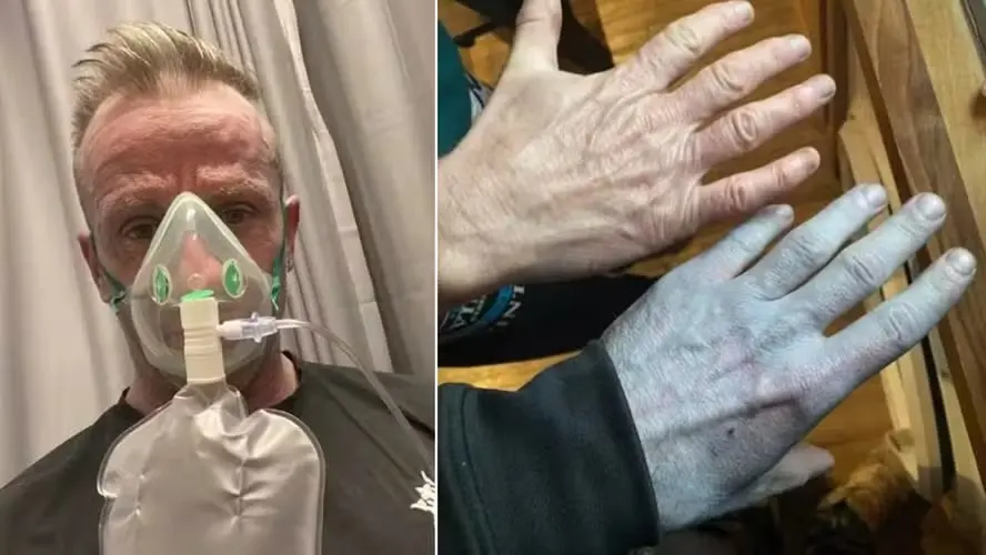 Laudo Médico Revela Porque Homem Acordou Completamente azul… Ver Mais