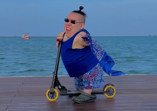 Dia triste, o influenciador Alejo Little, de 90cm, acaba de nos deixar após sofrer… Ver mais