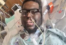 homem perde bracos e pernas redes sociais widexl