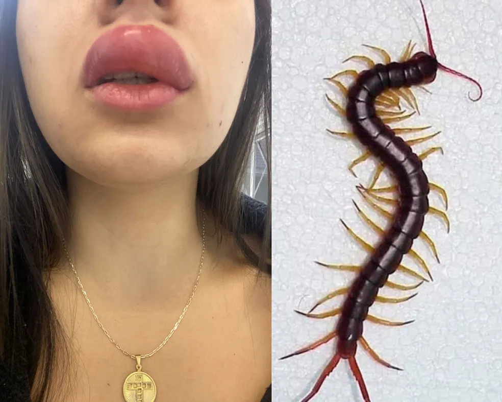 Se Este Bicho Começou a Aparecer na Sua Casa, Não Ignore: O Motivo Pode Estar no Próprio Ambiente… Ver mais