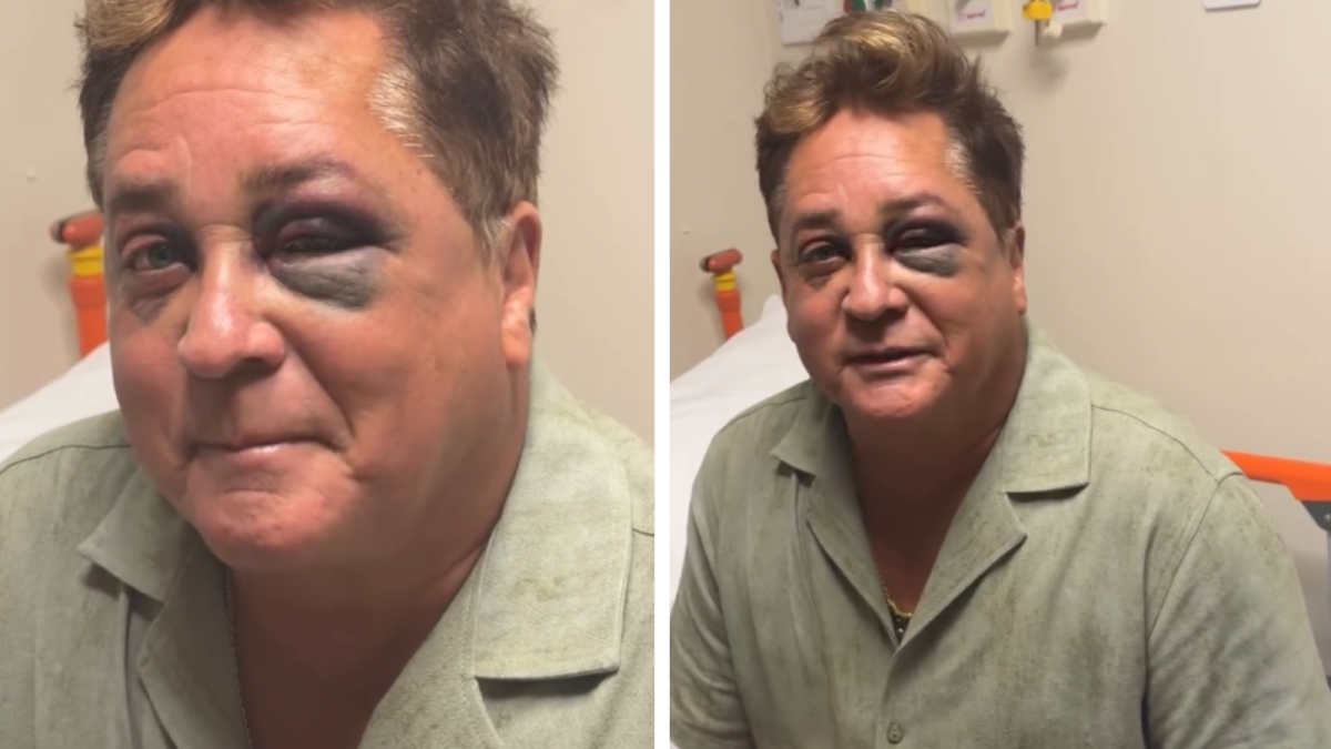 Acaba De Vaz4r Foto De Leonardo Logo Após Ac!dente Sofrido “Rosto Completamente Ac… Ver Mais